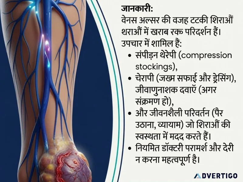 Venous ulcer treatment