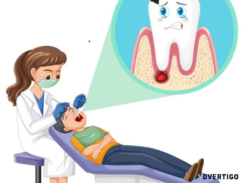 Emergency root canal for fast tooth pain relief