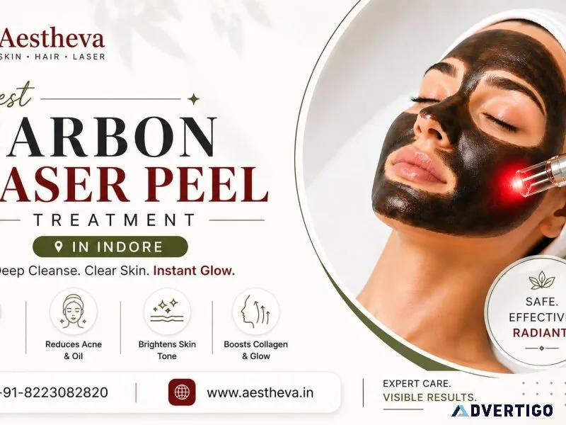 Best carbon laser peel treatment in indore aestheva