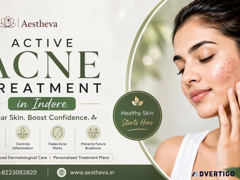 Active acne treatment in indore aestheva