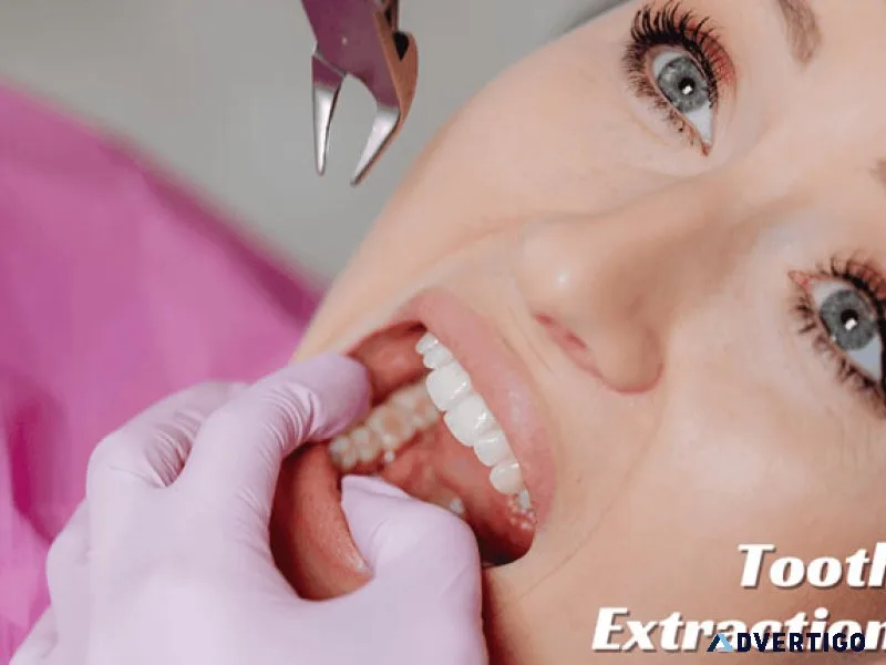 Tooth removal cost is not always the same