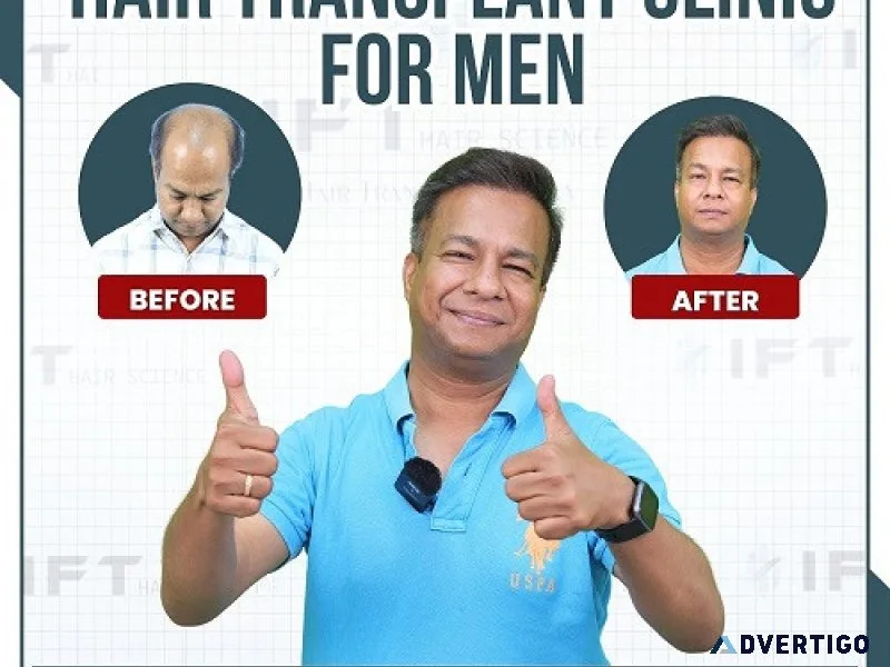 Best men hair transplant doctor in india