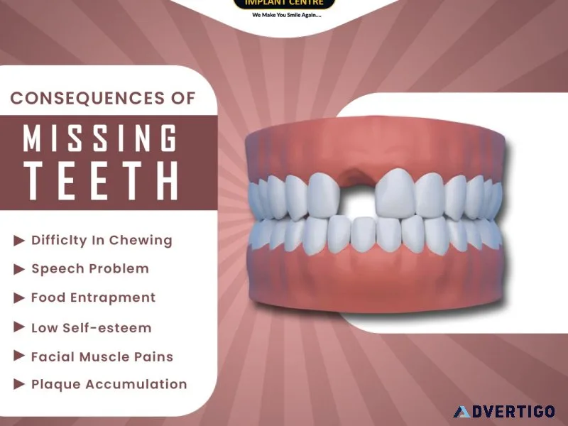 10 reasons you should never ignore a missing tooth