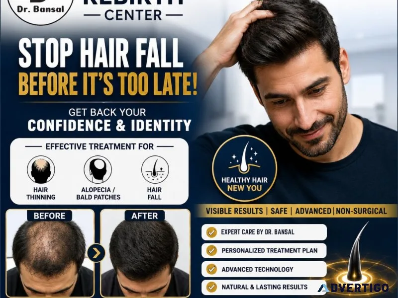 Alopecitia treatment