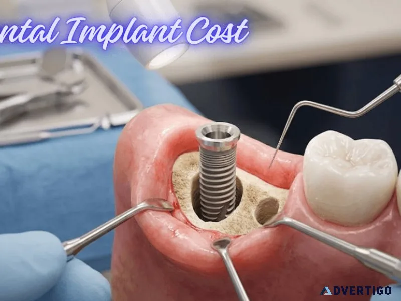 Understanding tooth implant cost in mumbai before treatment