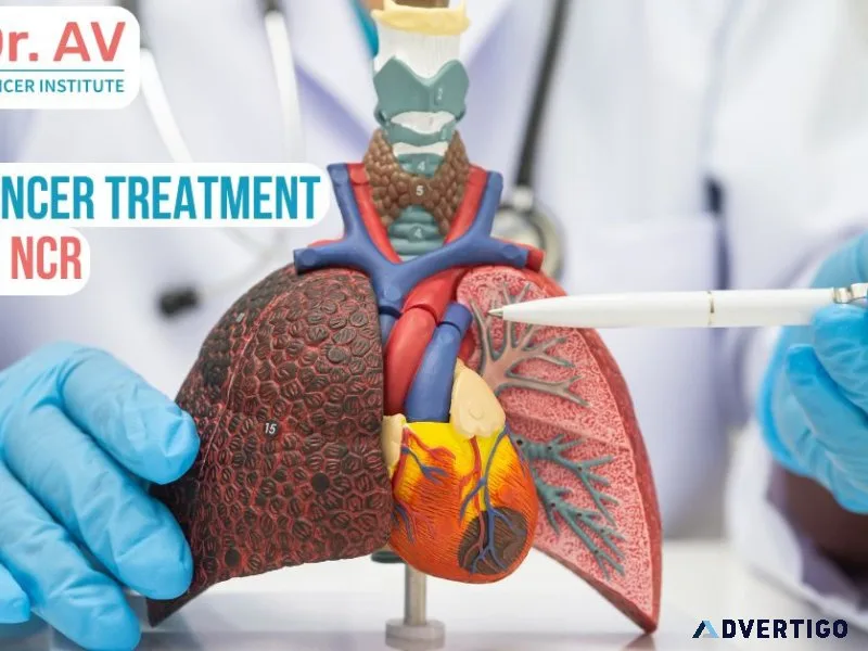 Professional lung cancer treatment in delhi ncr with personalize