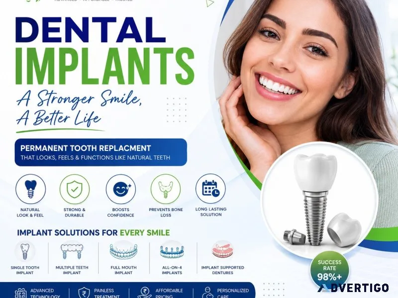 Dental implants in ahmedabad jahnavee dental care