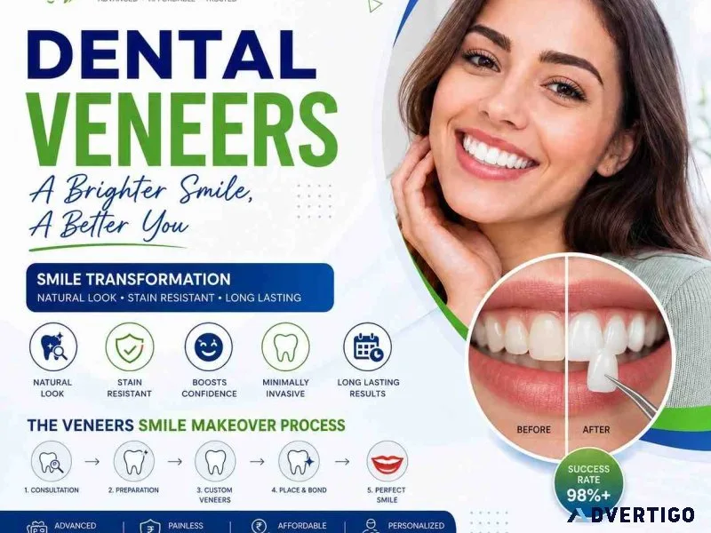 Cosmetic dental veneers treatment jahnavee dental care