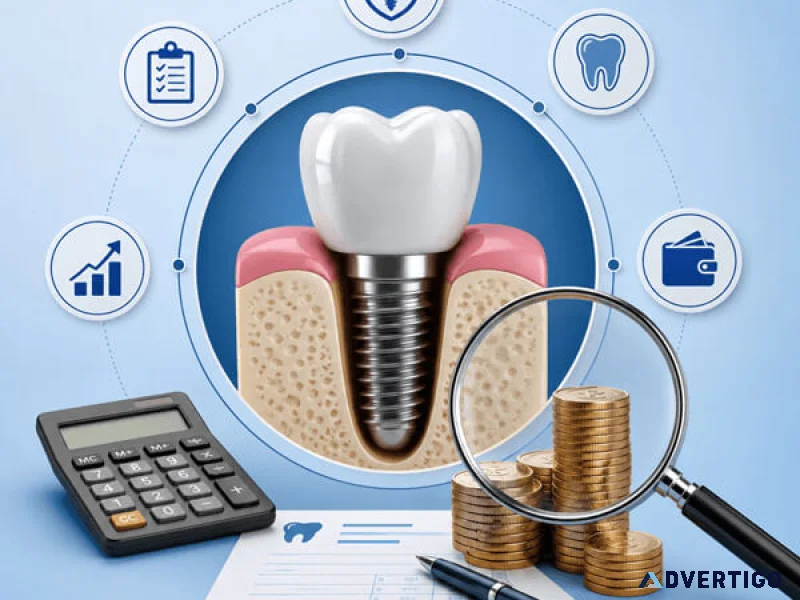What is dental implant cost in nepal