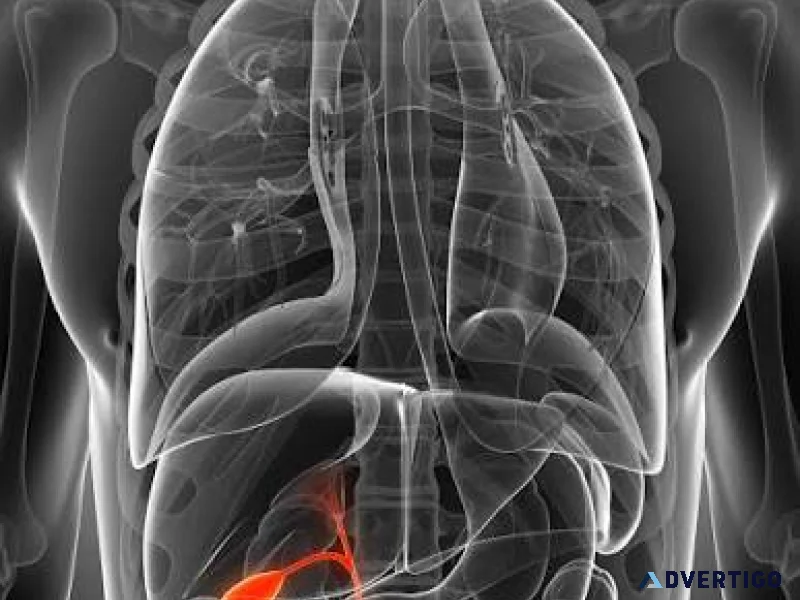 Advanced gallbladder treatment surgery in delhi