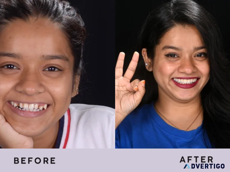 A cosmetic dentist who gives attention to your facial structure