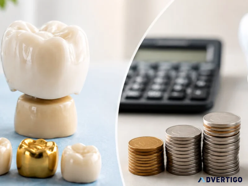 How much does a dental crown cost in nepal