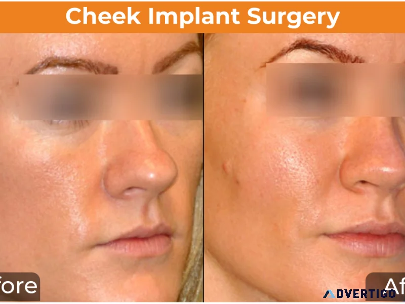 Best antiaging face wrinkle treatment in mumbai dr rinky k