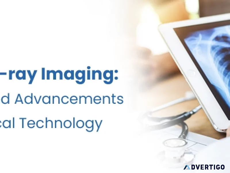 Digital x ray scanner test in hyderabad