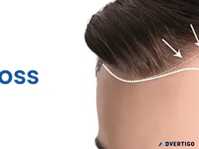 Hairfall checkup package in hyderabad
