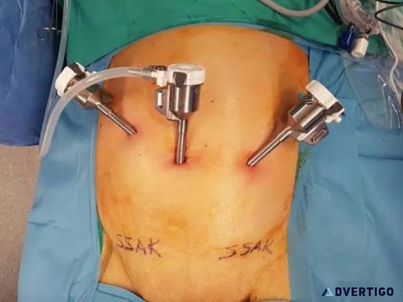 Hiatal hernia treatment