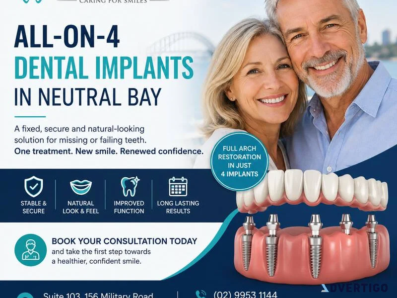 Allon4 dental implants in neutral bay for a secure new smile
