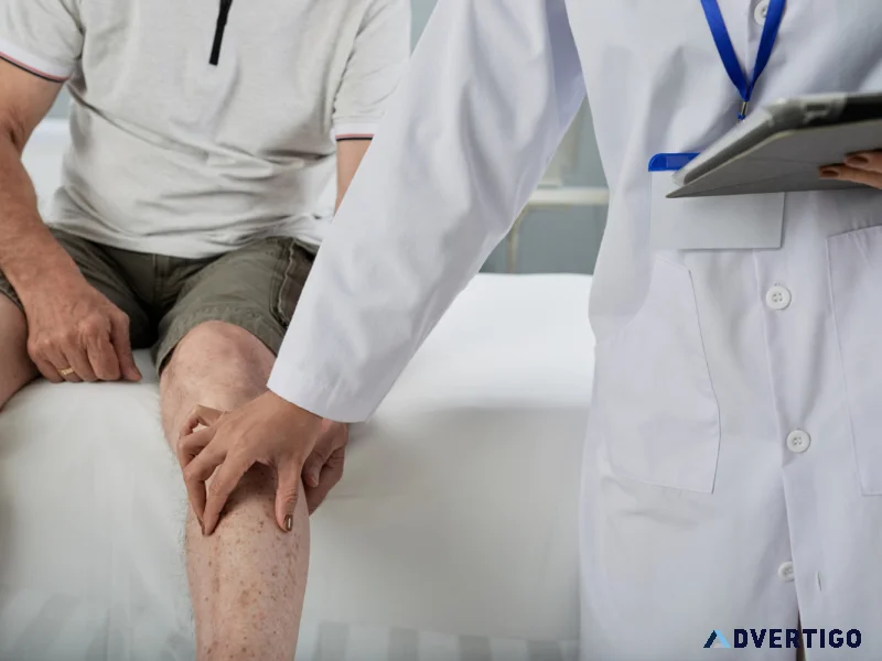 Varicose veins specialist doctor in delhi
