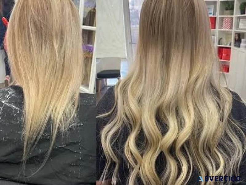 Book online private hair loss consultation in dallas