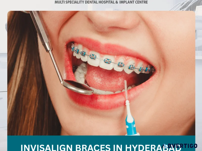 Invisalign braces in vanasthalipuram for a confident smile
