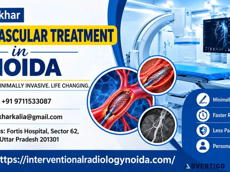 Endovascular treatment in noida