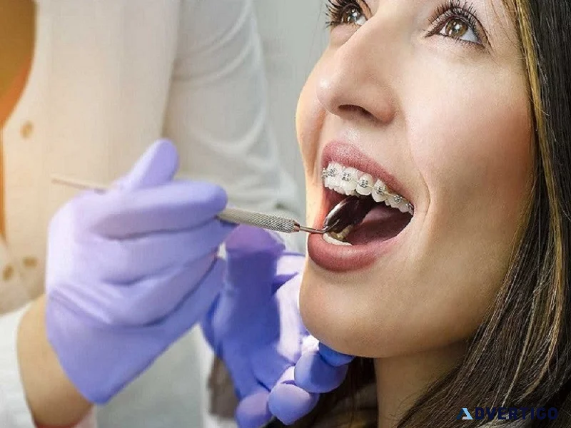 Need a walk in dentist in fort worth call prestige dental
