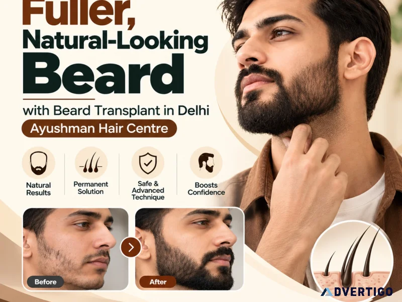 Beard transplant clinic in delhi restore your beard with natura