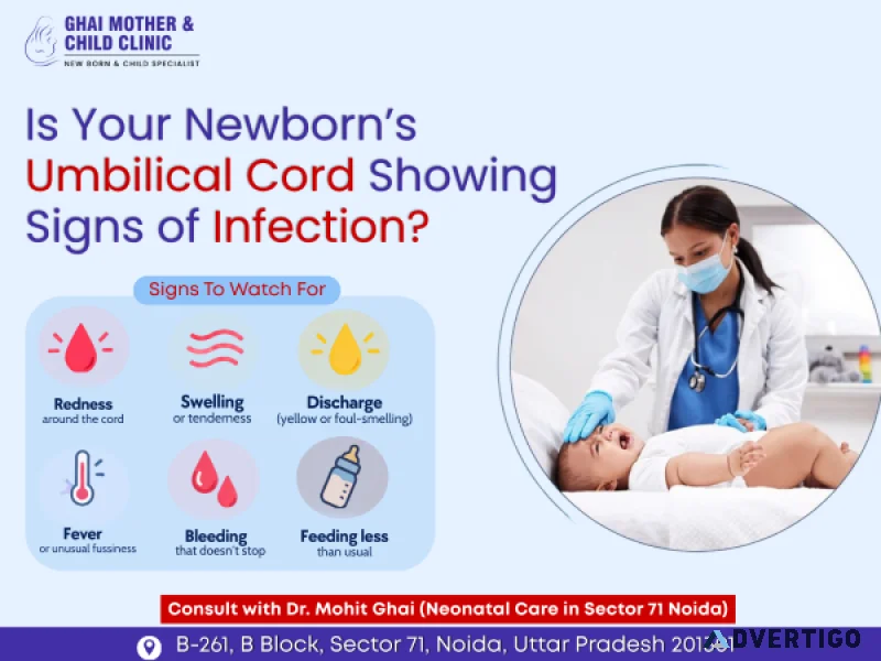 Umbilical cord infection neonatal care in sector 71 noida