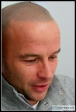 Scalp Micropigmentation (SMP)