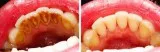 Dental hygiene services offered
