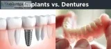 Best Implant Dentist in Delhi for best Dental Treatment