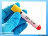 TSH Test - Learn More Get Results at Home and More