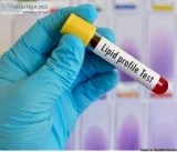 Lipid Profile Test - Learn More Get Results at Home and More