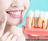 Root Canal Treatment
