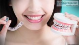 Looking for Braces treatment in Ahmedabad 