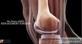 Knee Surgery Treatment View Cost Book Appointment