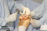 Get Musculoskeletal Problems Treated By Orthopedic Surgeon