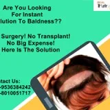 Tattoo Removal in Paschim vihar