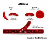 Sickle Cell Anemia Treatment in India