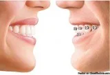 Find Best Orthodontist In DelhiSouth Delhi  Dr Kandhari Clinic