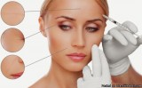 Mesotherapy Services in Toronto
