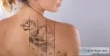 Tattoo Removal in Paschim vihar