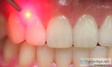 Gum Treatment with Laser