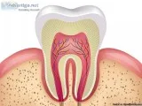 Affordable Root Canal Treatment in Delhi