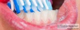 What is Biofilm