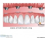 Improved Appearance Through Implant Supported Dentures