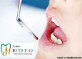 Best Implantologist Delhi Dental Clinic in Delhi