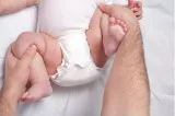 Diagnosis of Dysplasia of the Hip