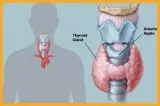 Thyroid Specialist Doctor in Chennai