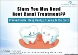 Root Canal treatment In Basavangudi Bangalore